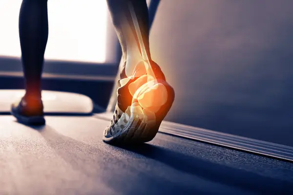 Heel Pain