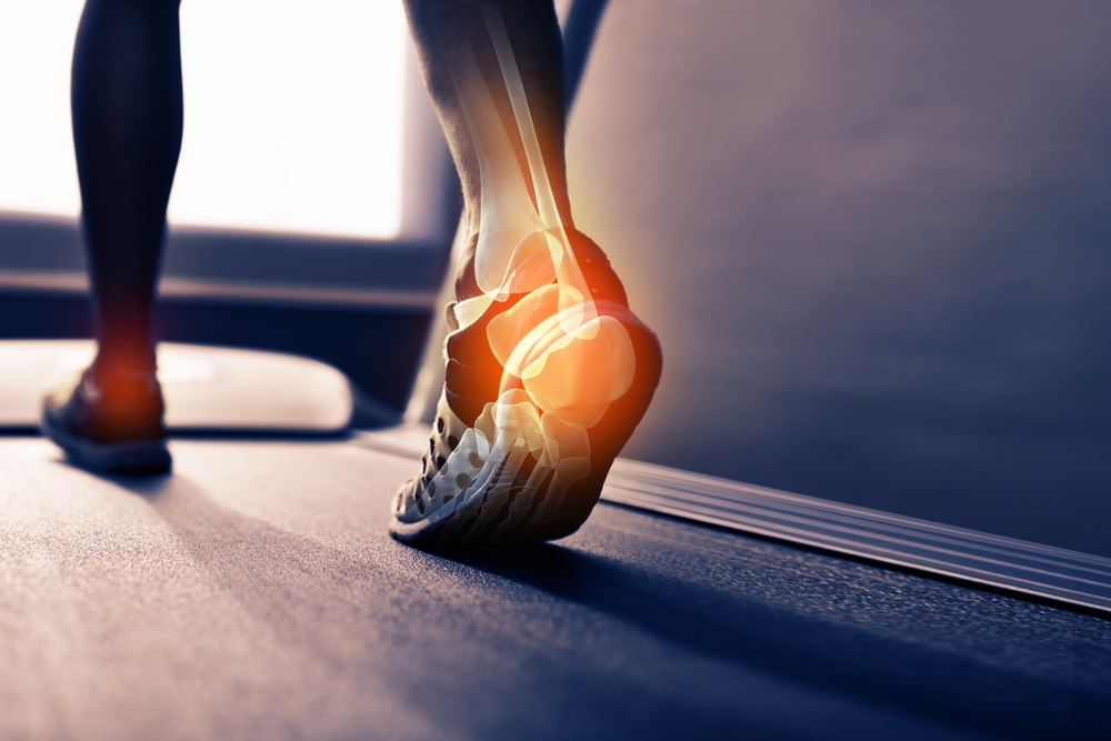 Arch pain with heel pain together